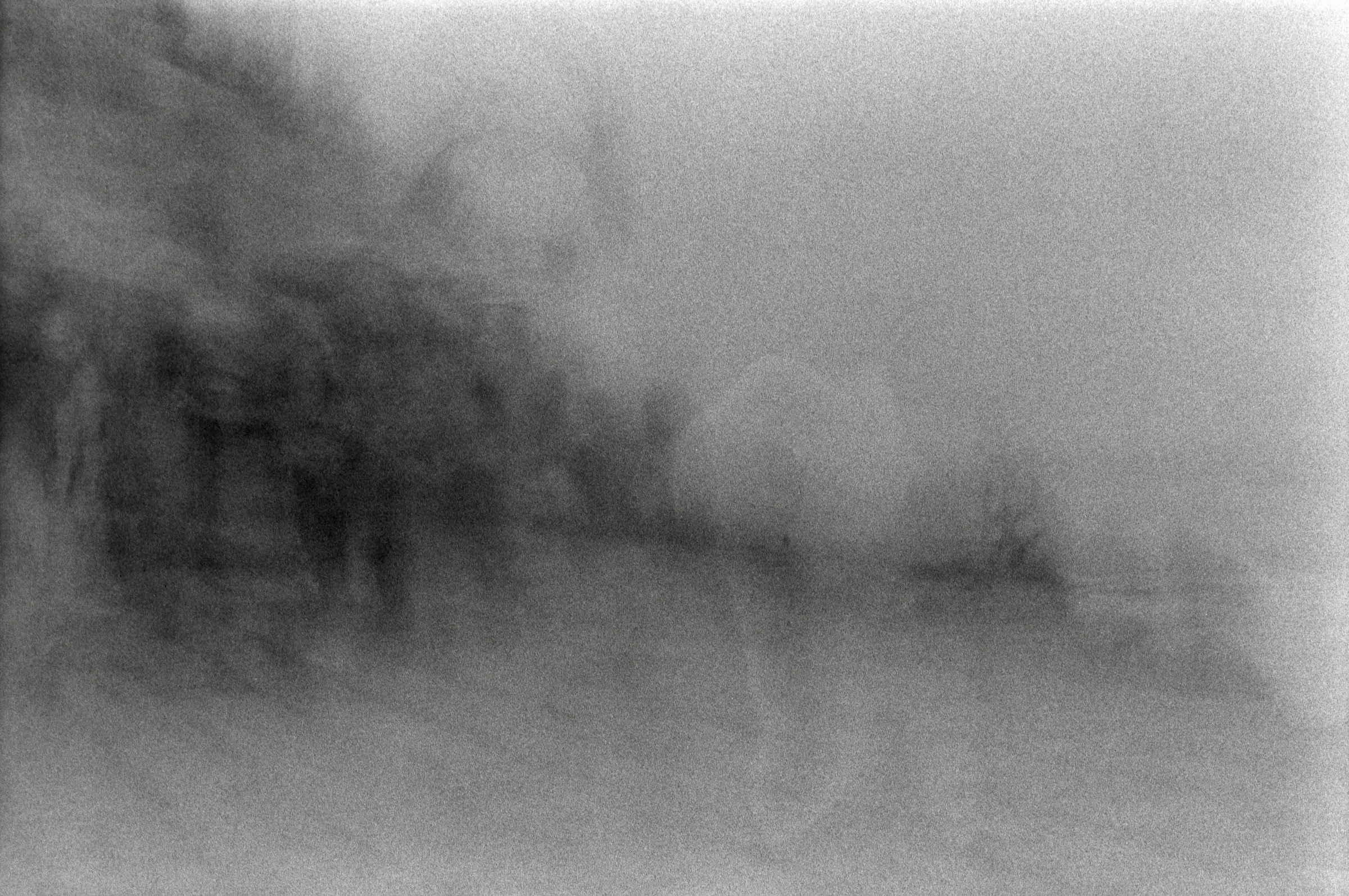 AHP F1995 05 012 sc240827 img28 NLP